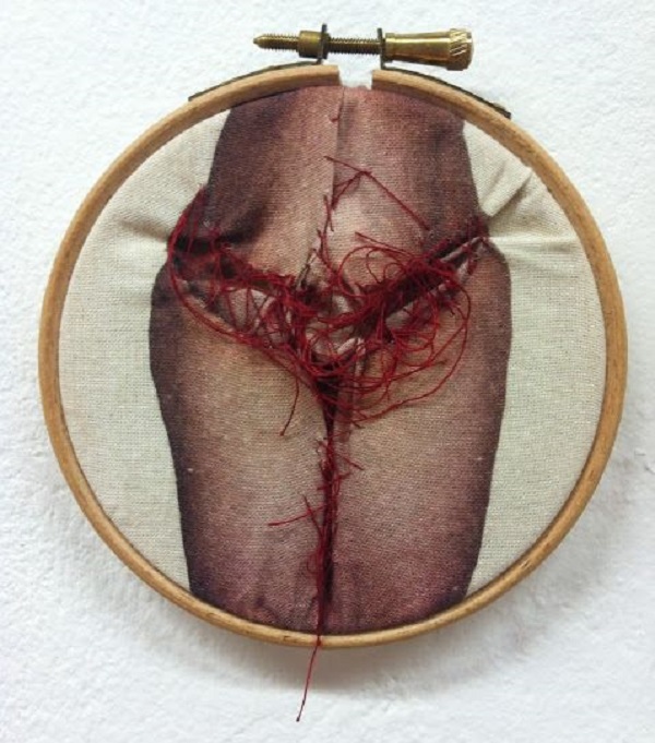 Jinekolog Muhabbetleri: ‘Vajinan kötü yapılmış!’ Kaos GL - LGBTİ+ Haber Portalı